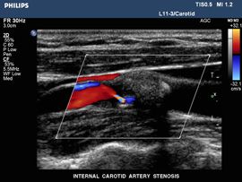 Neurologie/Gefässchirugie/Angiologie